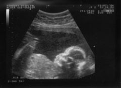 scan of our baby