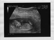 Picture of our second baby's scan